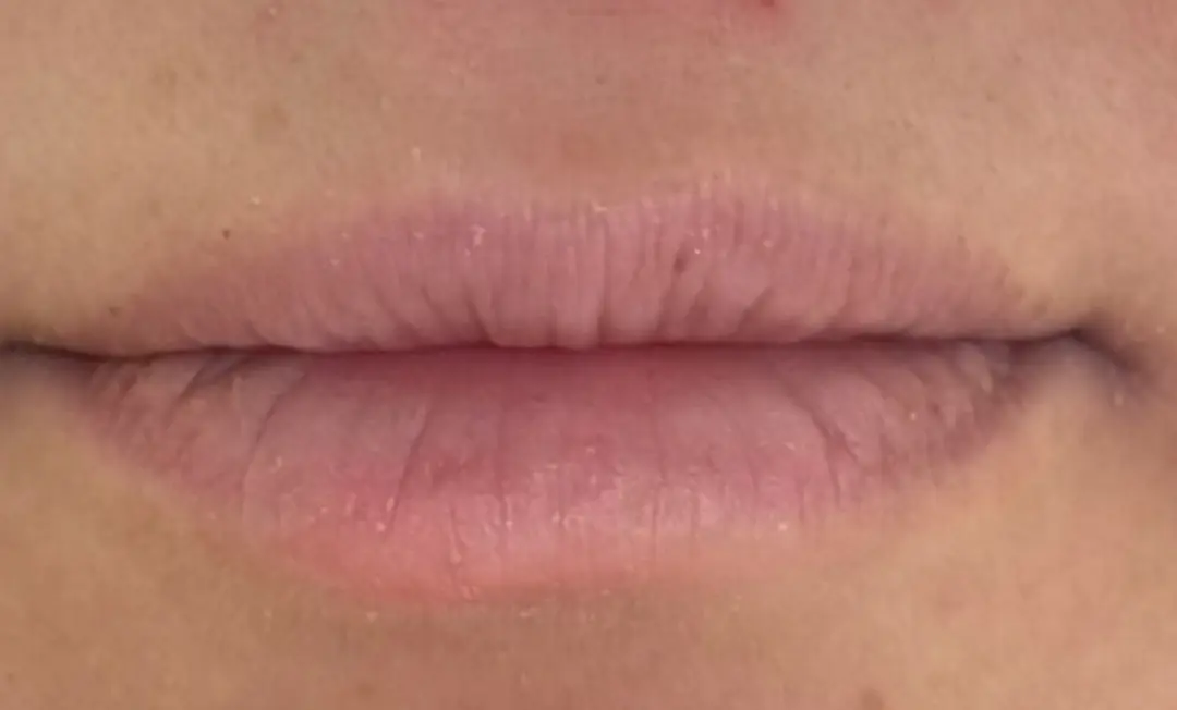 Bacio Lip Treatment