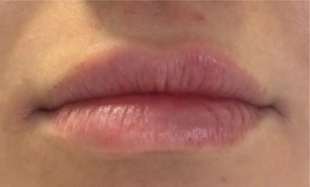Bacio Lip Treatment