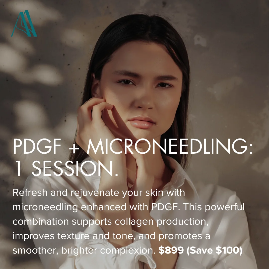 Buy Now - PDGF + Microneedling: 1 session 